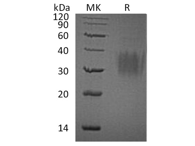 Recombinant Mouse IL-9 Protein (His-tag) (10 µg)