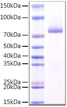 Recombinant Mouse SIRP alpha (CD172a) Protein (His-tag) (100 µg)